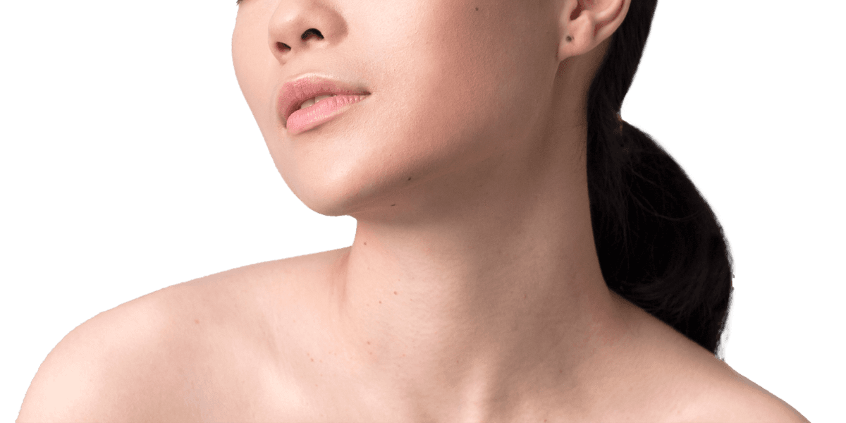 image-overview-doublechin