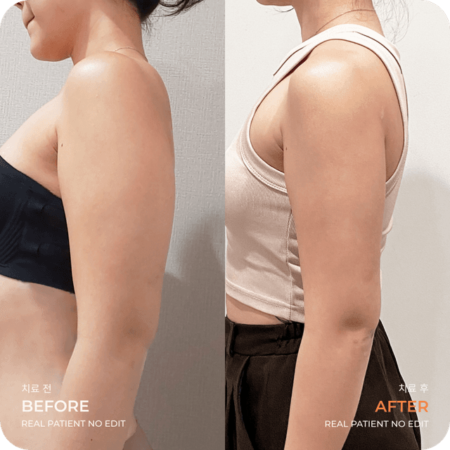 Patient after LAMS treatment showing positive results