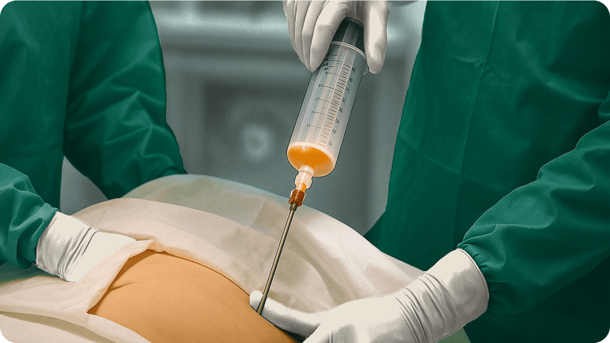 treatment-image