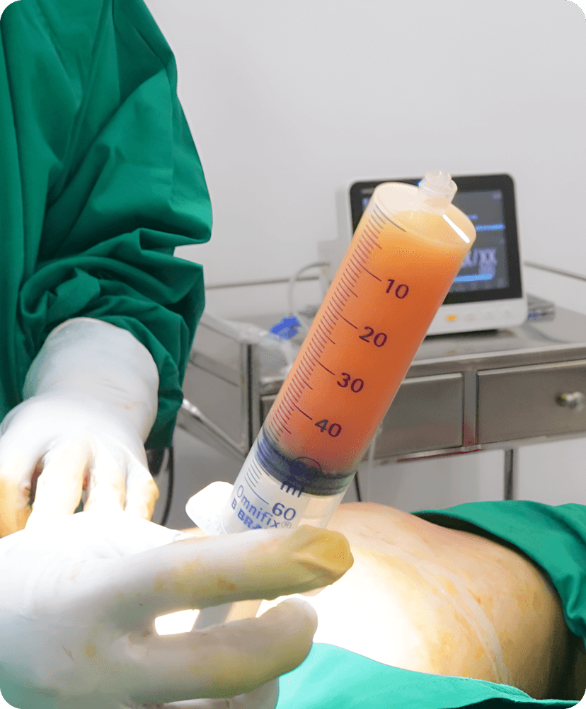 Detailed illustration of the LAMS procedure highlighting its minimally invasive nature